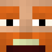 Skin Head