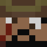 Skin Head