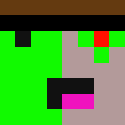Skin Head