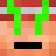 Skin Head