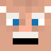 Skin Head