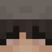 Skin Head