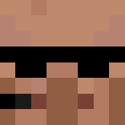 Skin Head