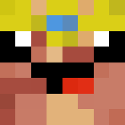 Skin Head