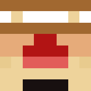 Skin Head