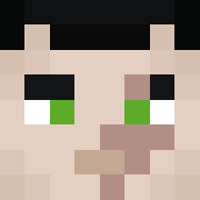 Skin Head