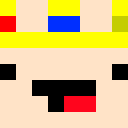 Skin Head