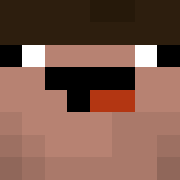 Skin Head