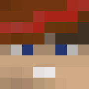 Skin Head