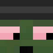 Skin Head