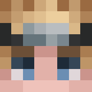 Skin Head