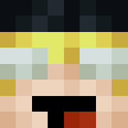 Skin Head