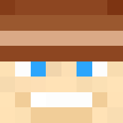 Skin Head