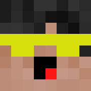 Skin Head