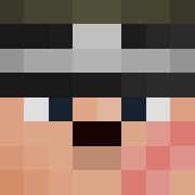 Skin Head