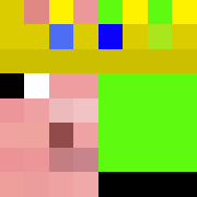 Skin Head