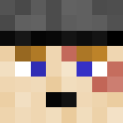 Skin Head