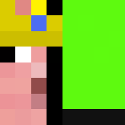 Skin Head