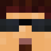 Skin Head