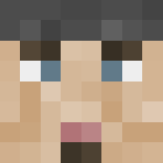 Skin Head