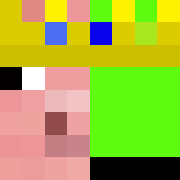 Skin Head