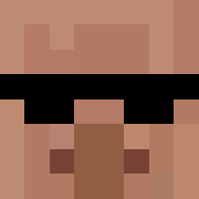 Skin Head