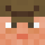 Skin Head