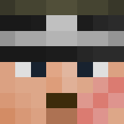 Skin Head
