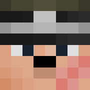 Skin Head