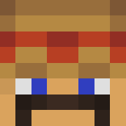 Skin Head