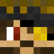 Skin Head