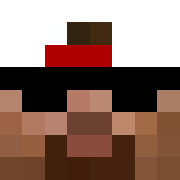 Skin Head
