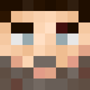 Skin Head