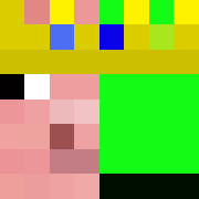 Skin Head