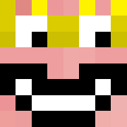 Skin Head