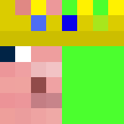 Skin Head