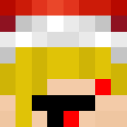 Skin Head