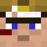 Skin Head
