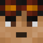 WiederDudeVedec's Head