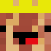 Skin Head