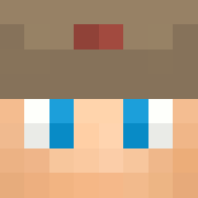 Skin Head