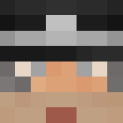 Skin Head
