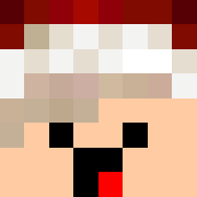 Skin Head