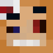 Skin Head