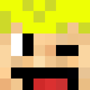 Skin Head