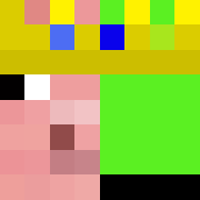 Skin Head