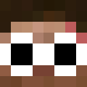 furculaedmc