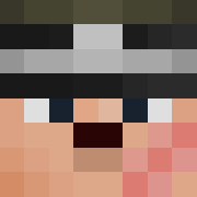 Skin Head