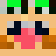 Skin Head