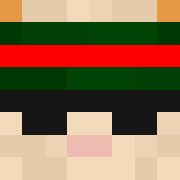 Skin Head